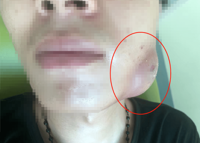 突然的疫情，突然疫情泰坦英雄人死掉
